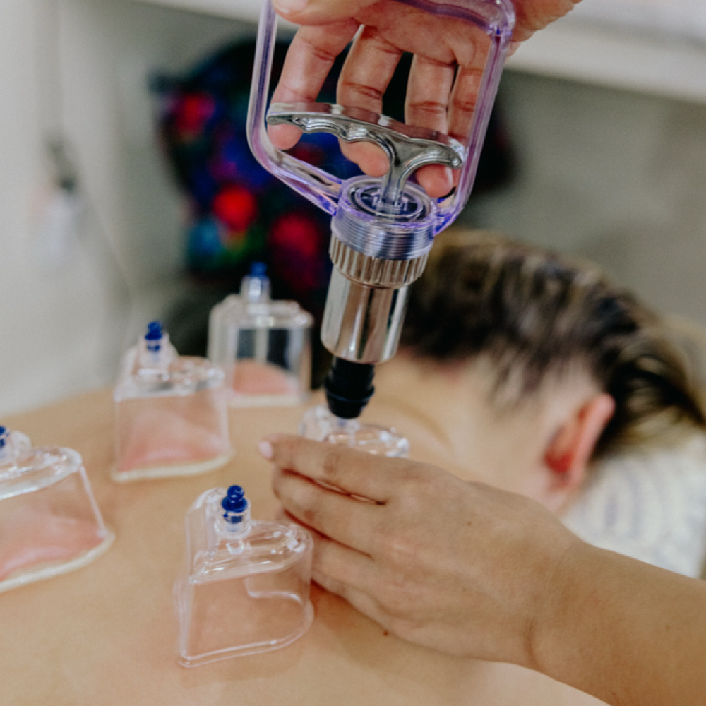 Cupping Therapy at Zenful-Handz holistic spa in Indialantic, FL
