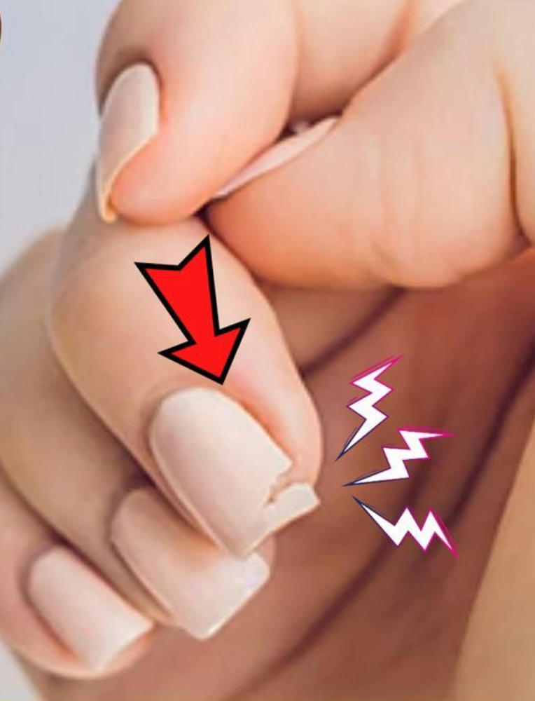 NAIL REPAIR