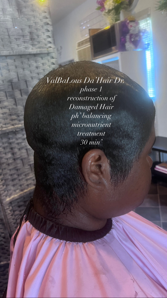 Alopecia Consult  W/One Treatment