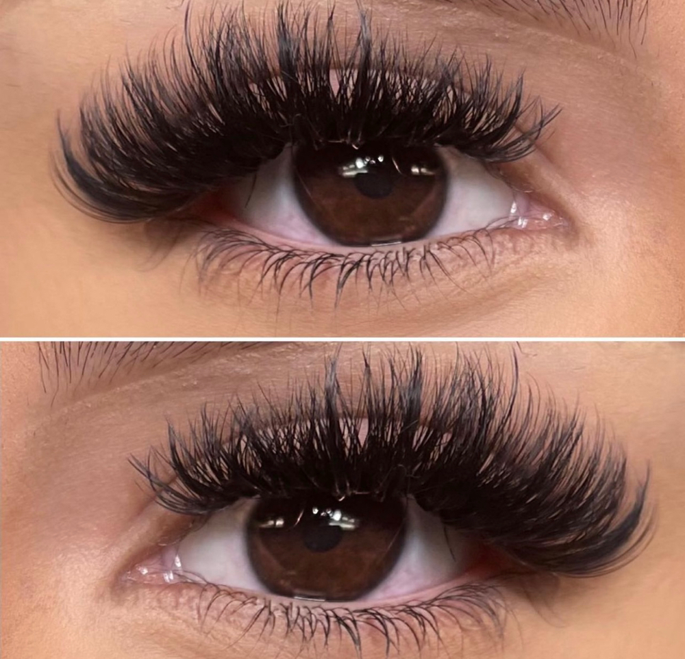 Volume Fill at Aura aesthetics in Red Bluff, CA