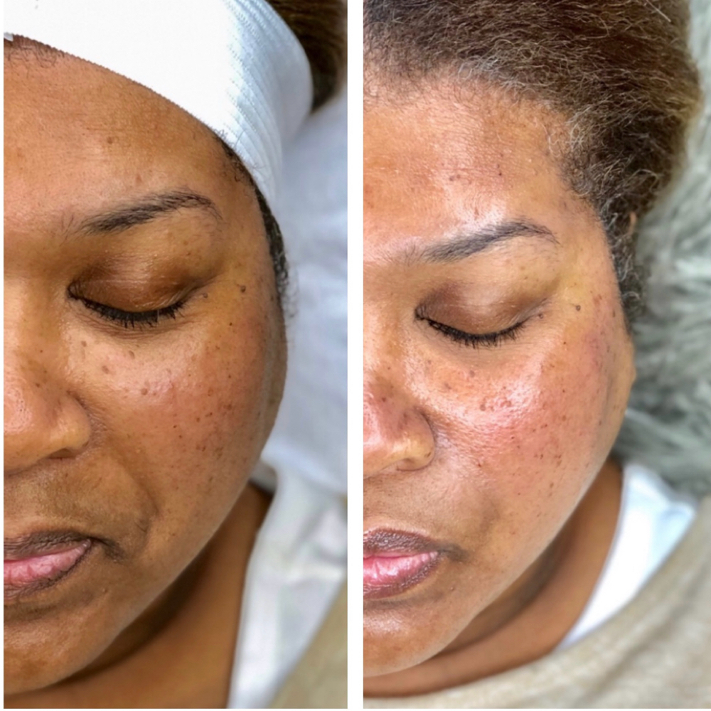 Brighten My Skin at Beauty Therapy by Chanel in Tucker, GA