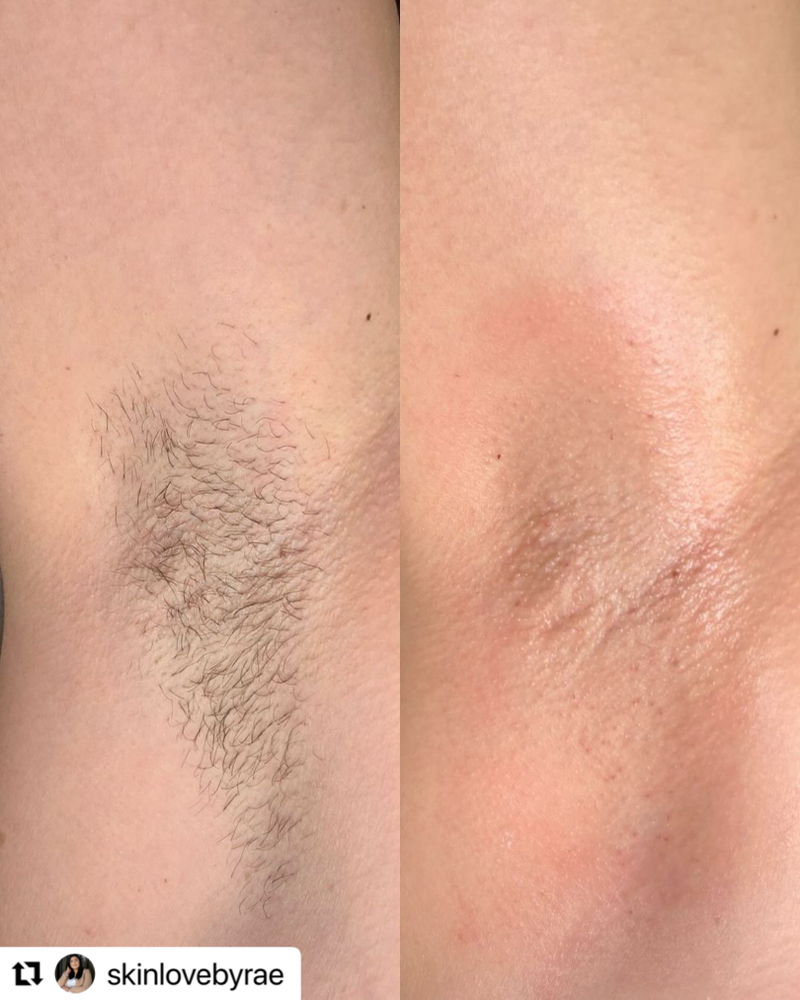 Underarm Wax