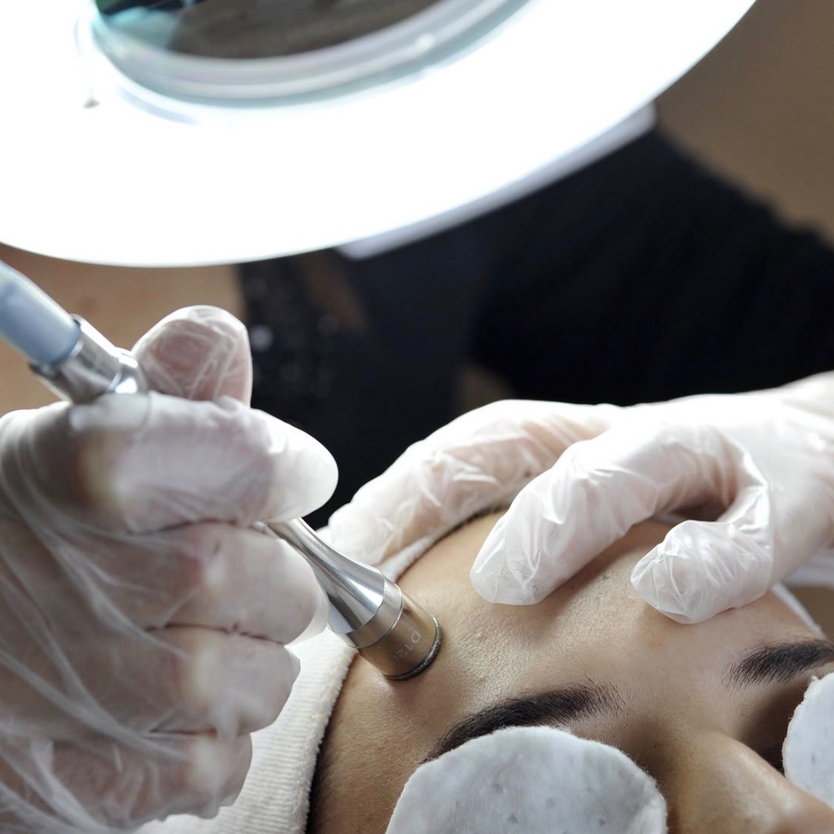 Microdermabrasion at Bare + Bronzed in Fort Worth, TX