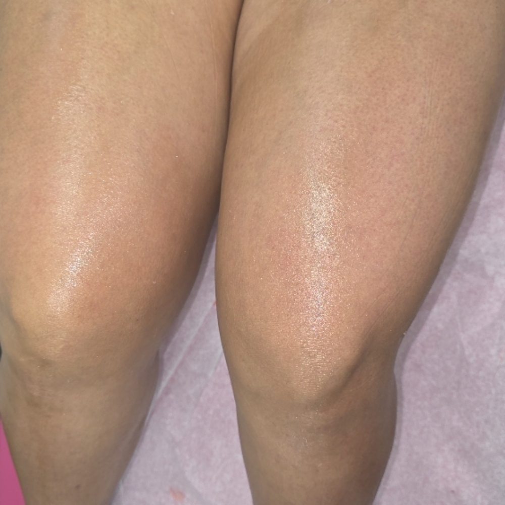 Waxing - Half Legs at Celtic Spa Laser Services in Attleboro, MA
