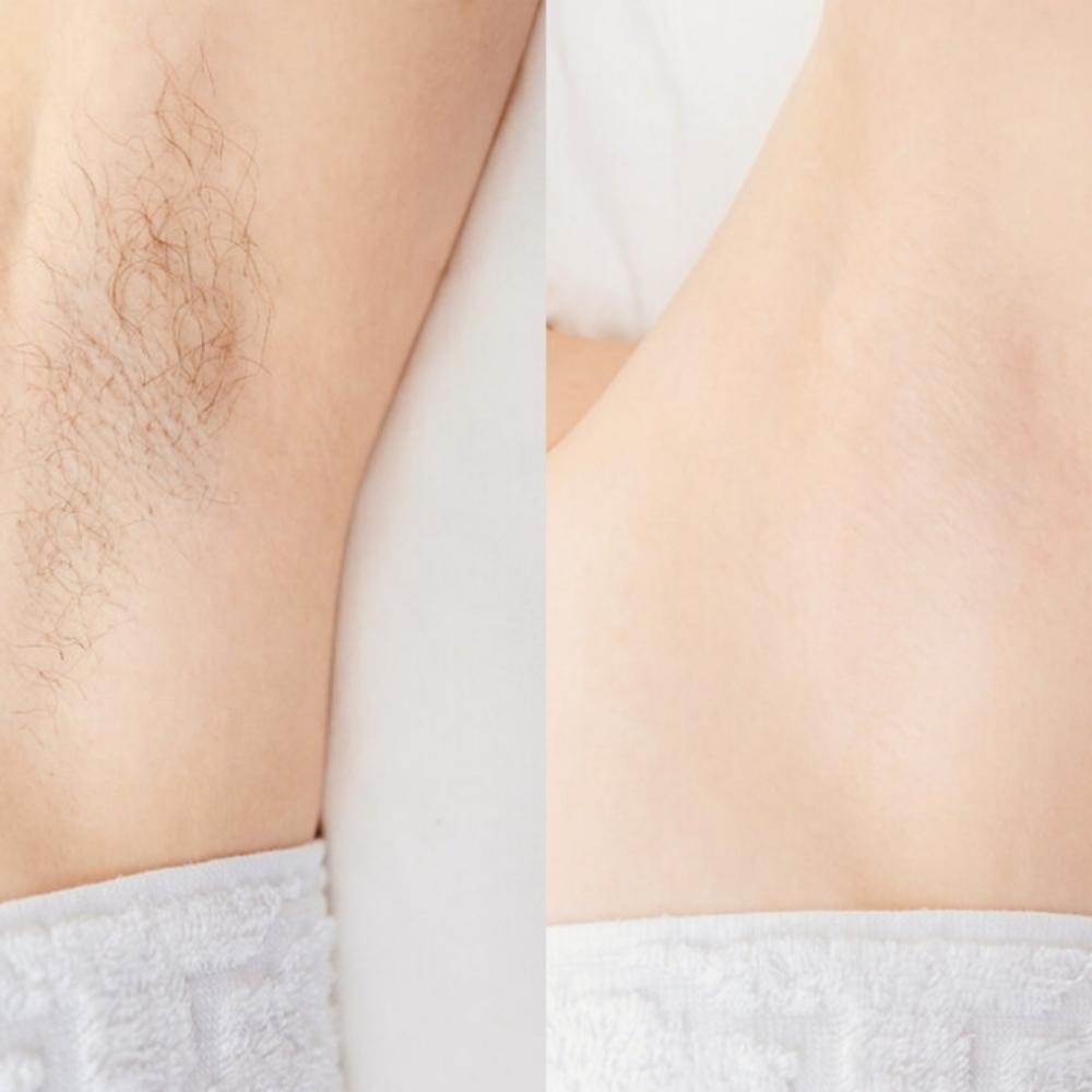 Content Model- UNDER ARM WAX at Luxe Life by Cheri' Antoinette in Ft HAUCHUCA, AZ