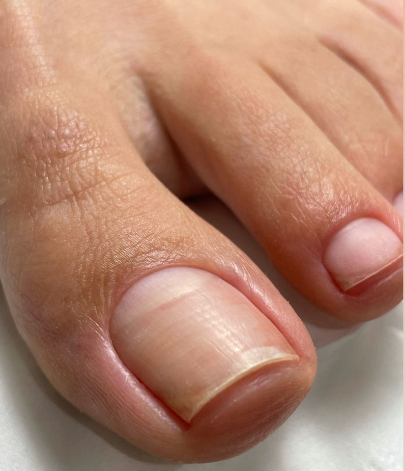 Smart Pedicure(no polish)