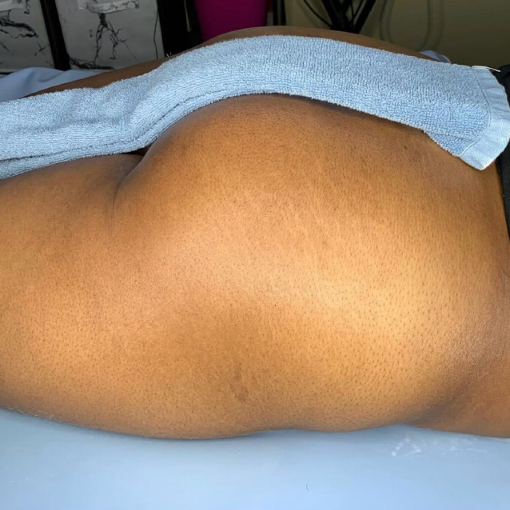 Butt Cheek Wax. at Quinta Esthetics in Terrytown, LA