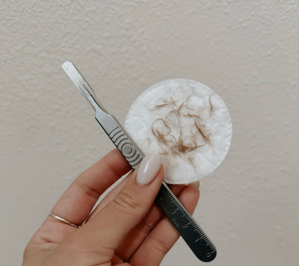 Dermaplaning at Beauty By Six in Woodstock, GA