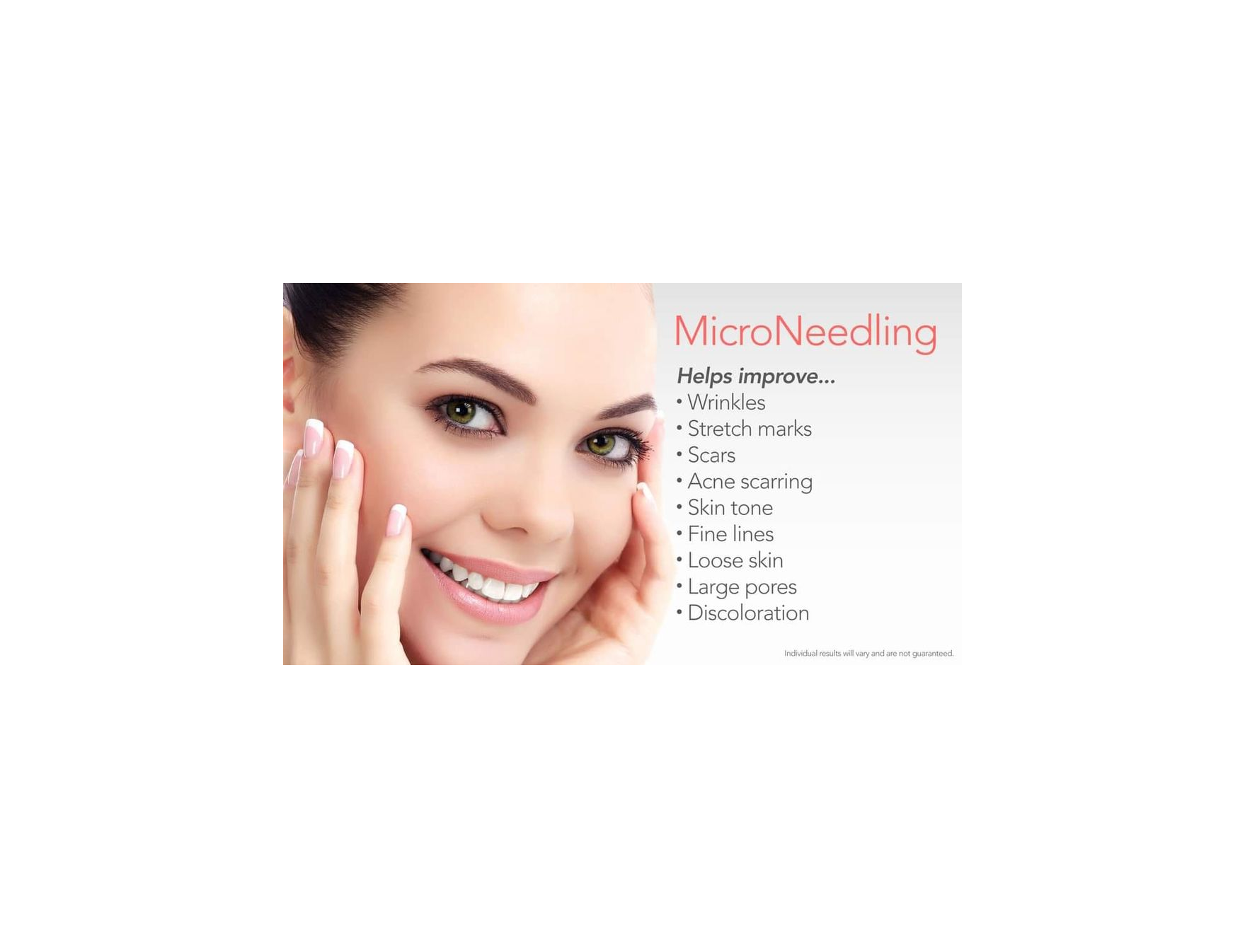 Microneedling