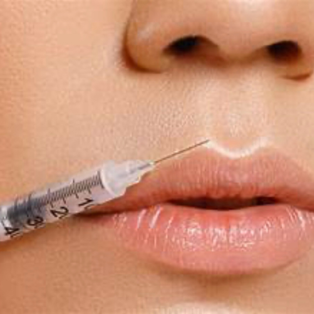 Lips, Chin and Cheek Filler at Merle Norman of Sharyland Spa and Boutique in Mission, TX