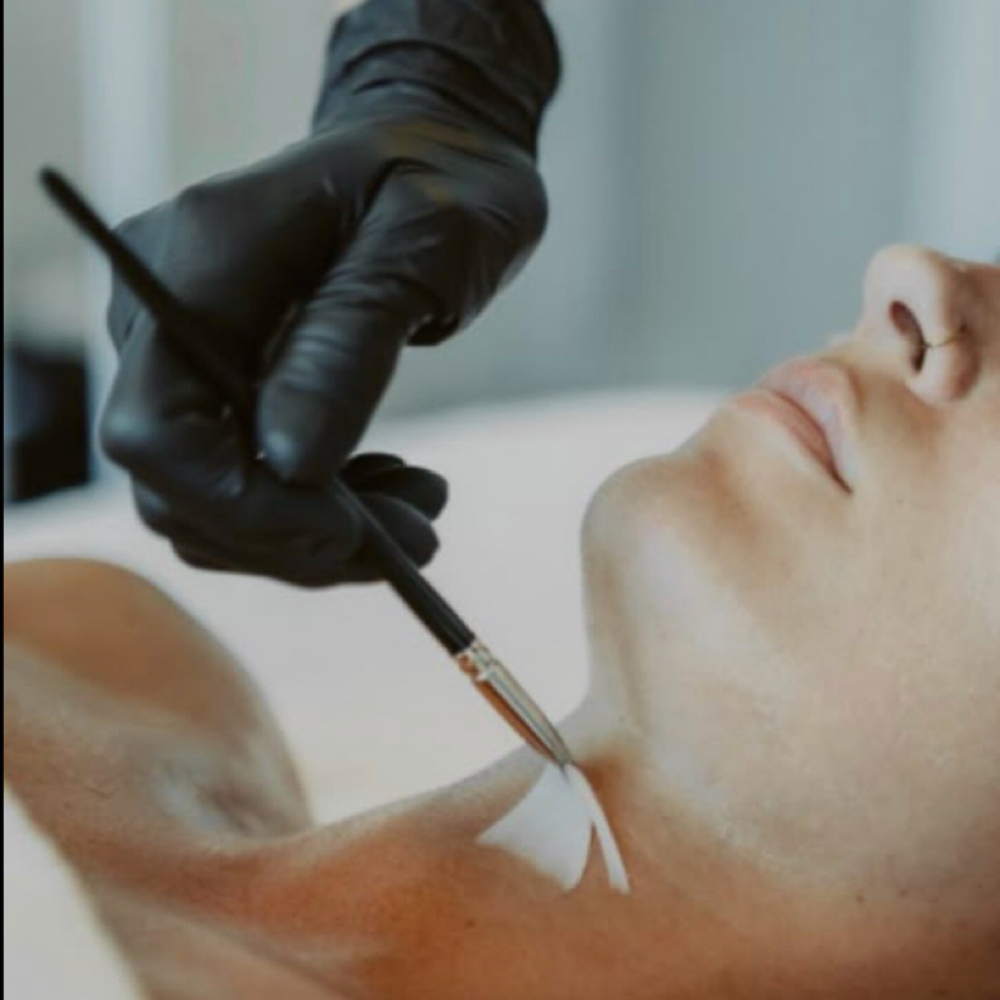 Neck & Deck at Retro Esthetics in San Clemente, CA