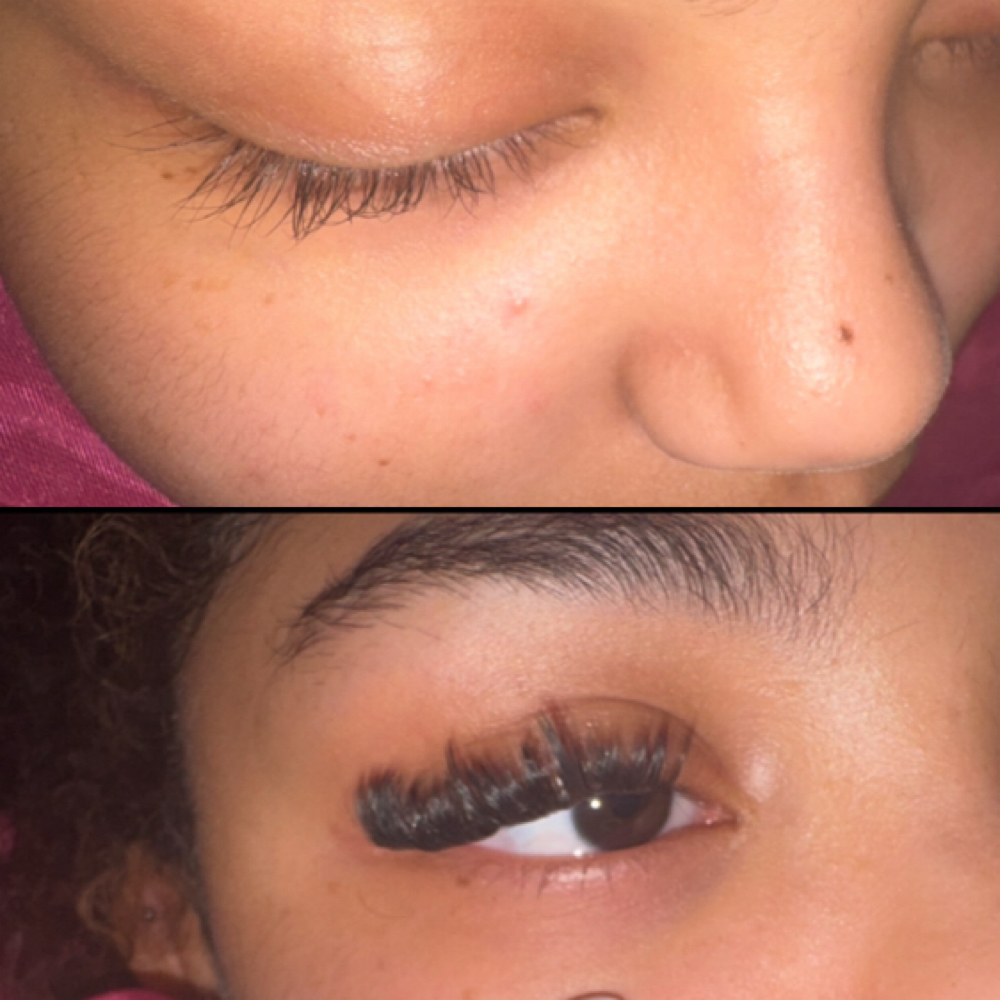 Volume Clusters at Queensmade Esthetics in Wilmington, NC