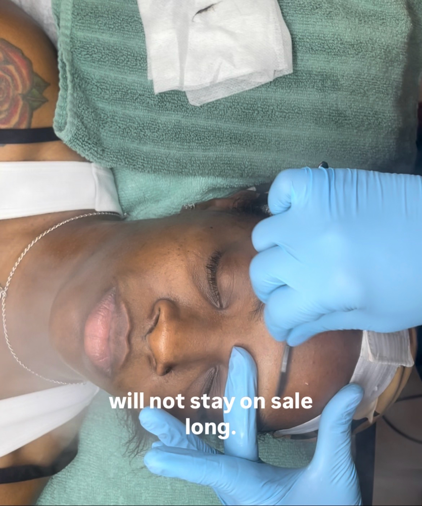 Retenoil Infusion Treatment