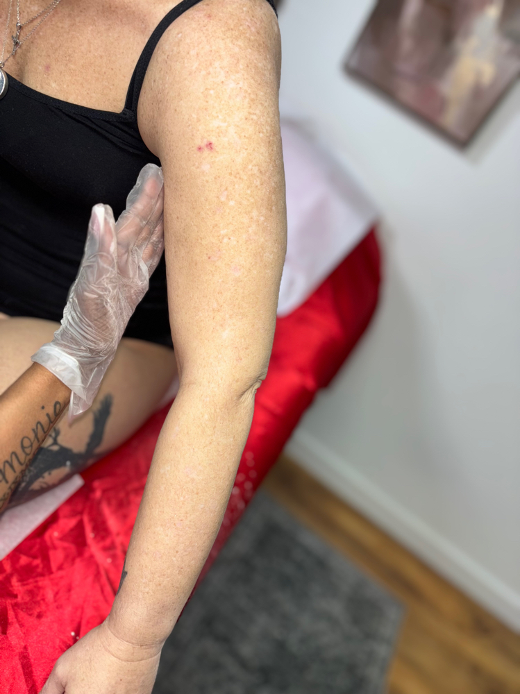 Full Arm