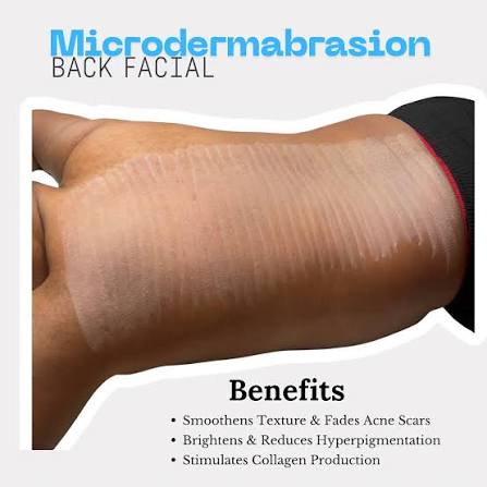 EliteElixir Microderm Back Facial at Beauty Cult Studio