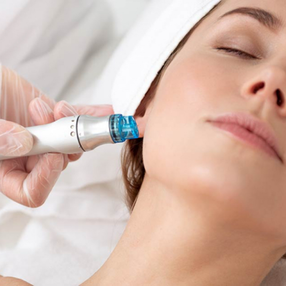 Hydrodermabrasion at Killer Vanity in Warrenton, VA