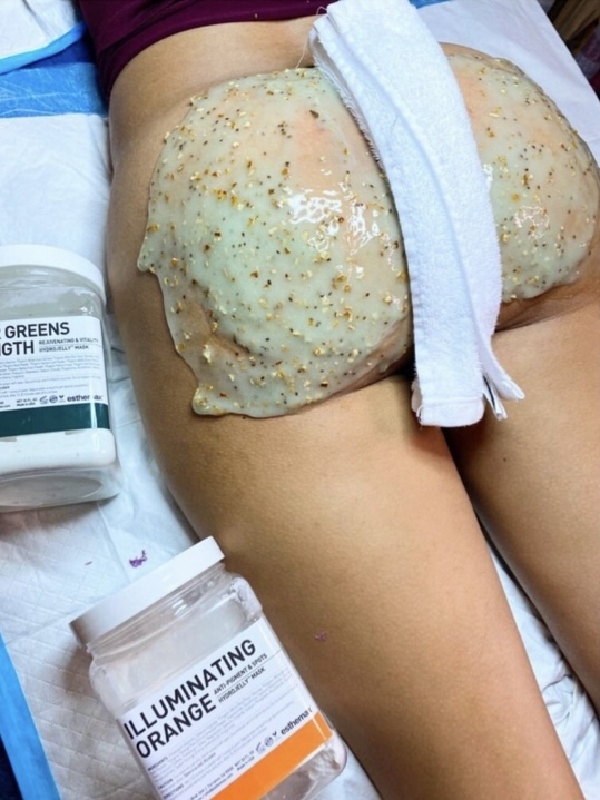 Prickly Buns Bum Treatment