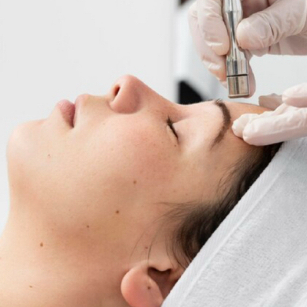 Diamond Microdermabrasion Facial at APMU MED SPA | Atlanta Aesthetics & Permanent Makeup in Marietta, GA