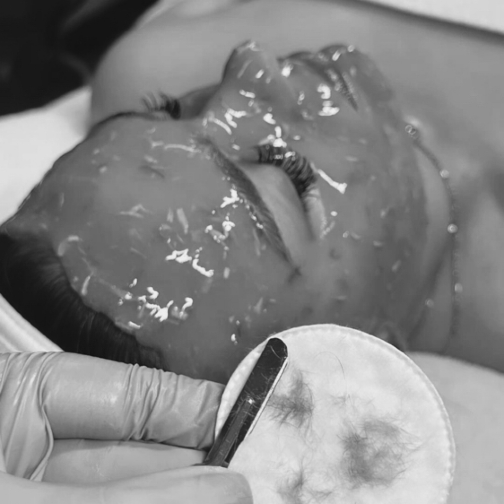 Dermaplane & Enzyme Facial at Summer Time Skin in West Plains, MO