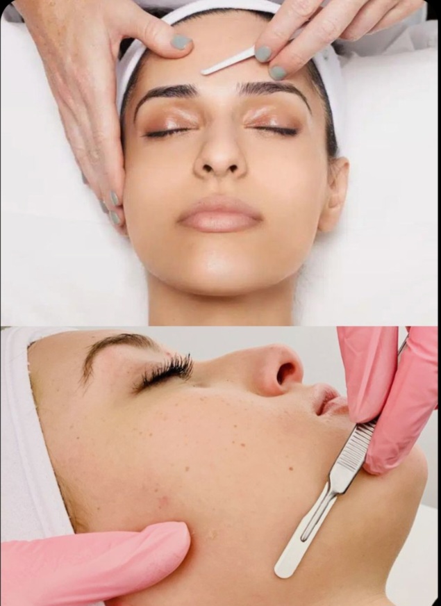 Dermaplaning Treatment