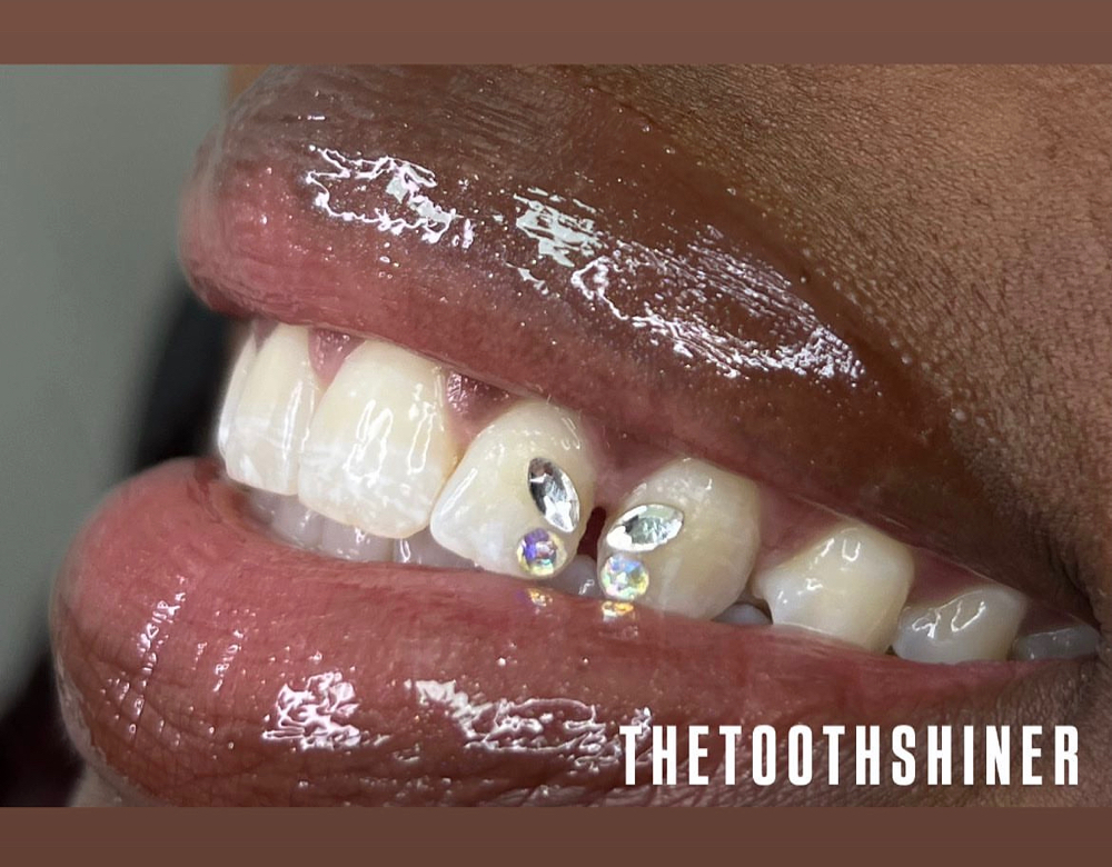 Butterfly Tooth Gem Set
