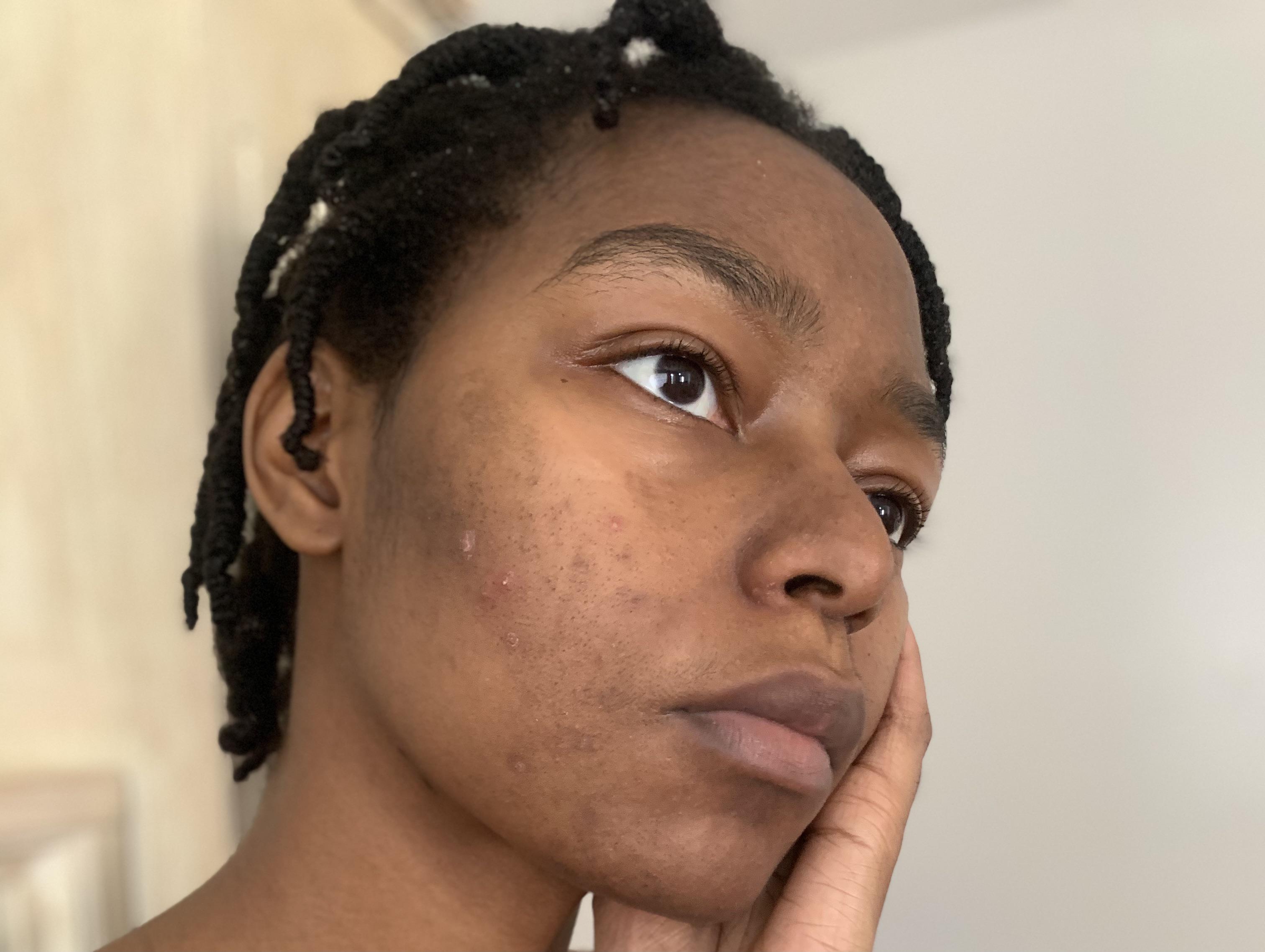 Microbiome Repair & Relief Facial