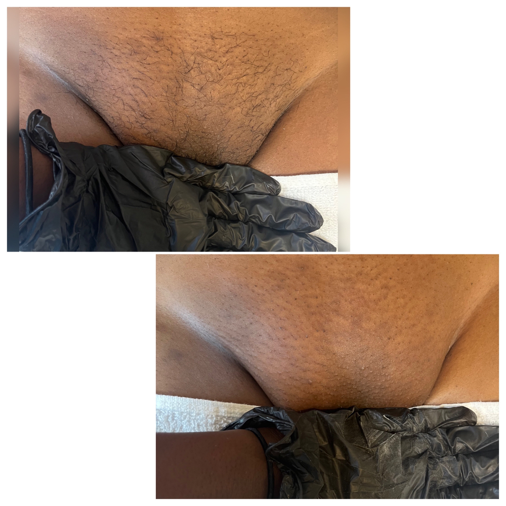 Brazilian Wax Special