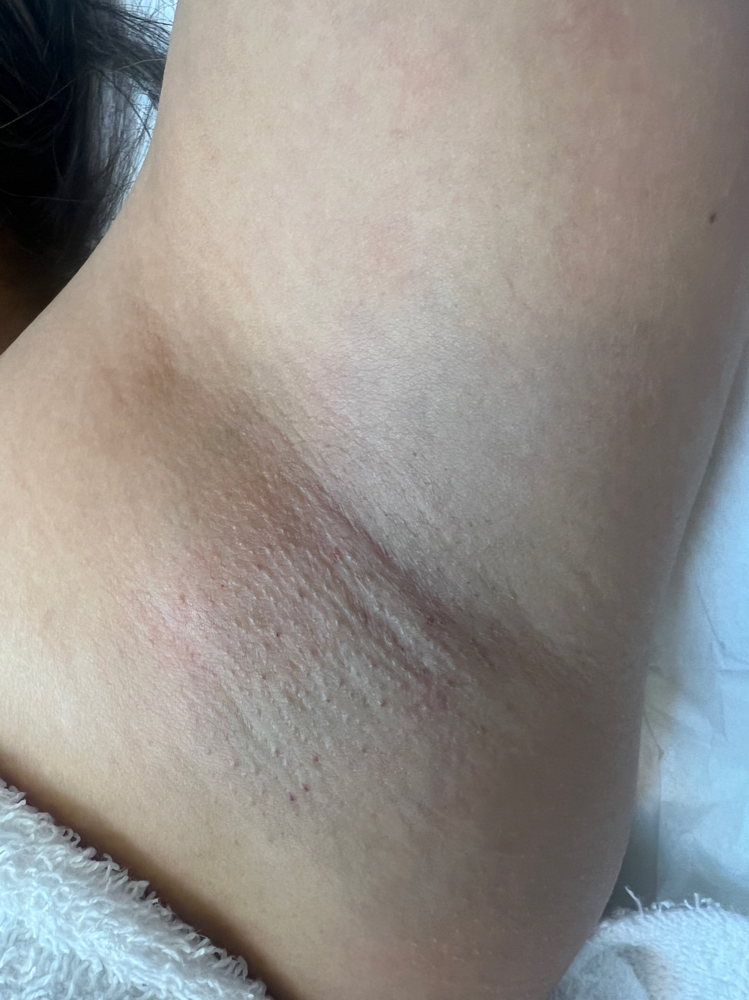 Under Arm Cleansing