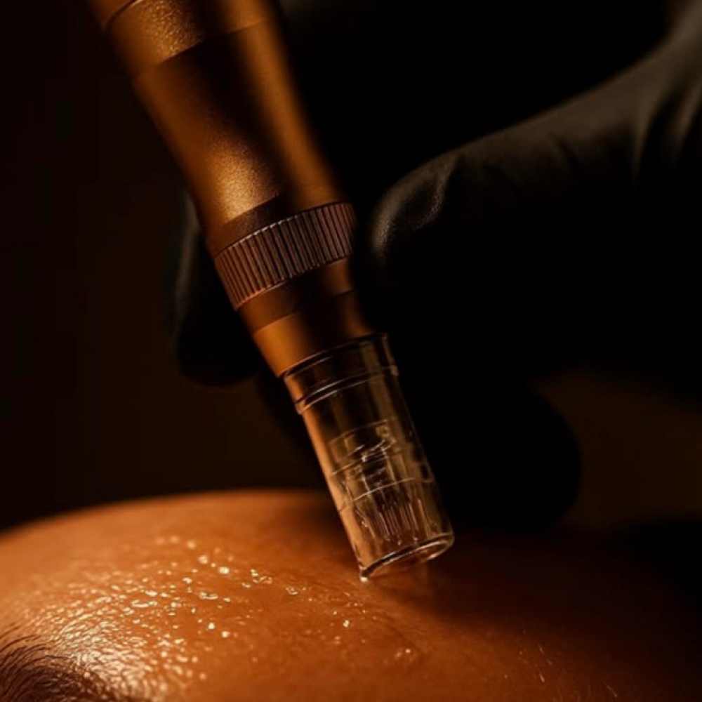 Microneedling at BSkinAesthetics in McKinney, TX