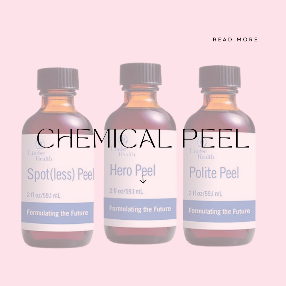 Custom Chemical Peel Pkg 3