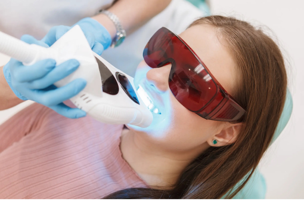 Teeth Whitening
