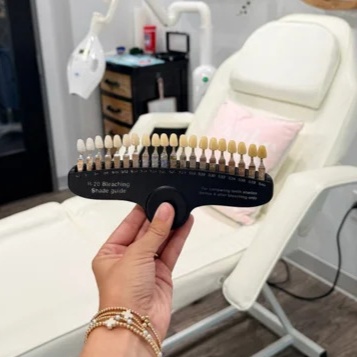 Signature Whitening -Most Popular at Smile Labs Charlotte in 28277