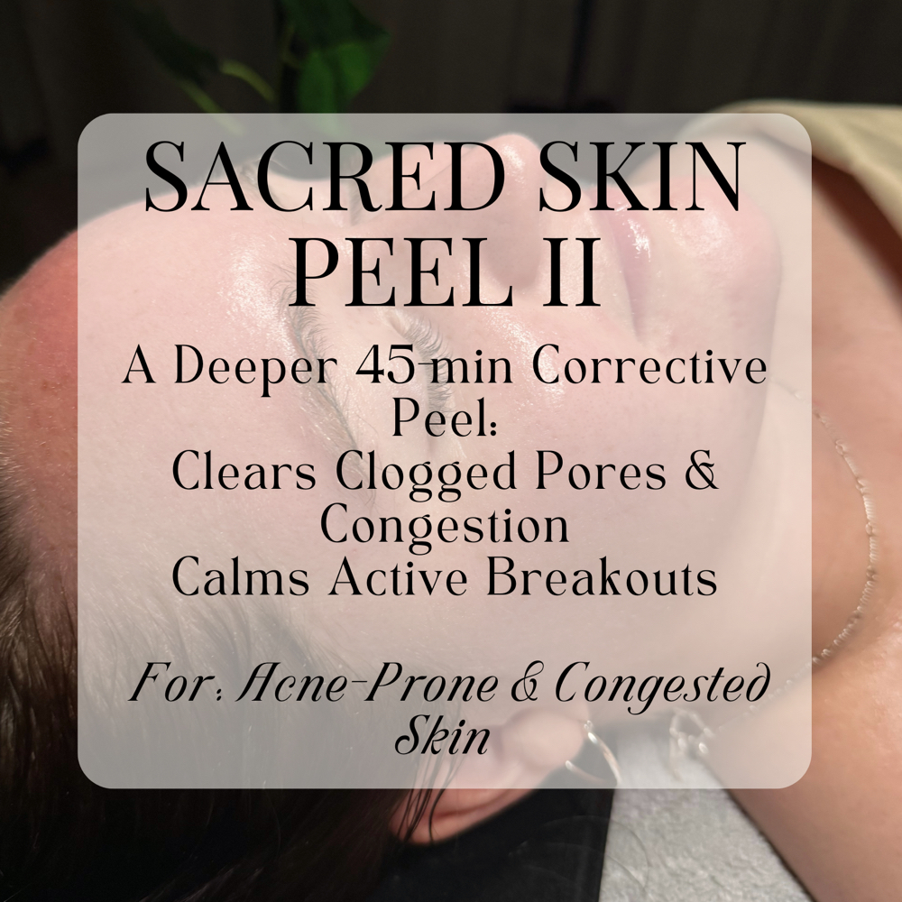 Sacred Skin Peel - II at Skin by Gia in Pueblo, CO