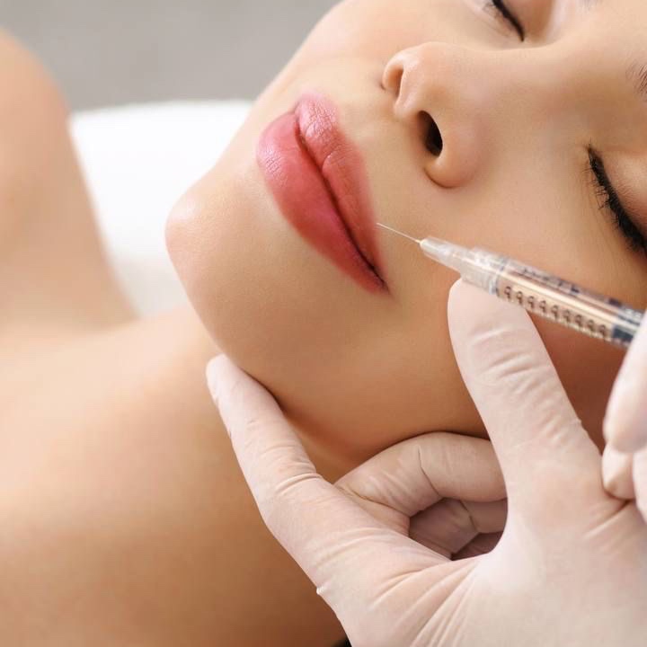 1/2 SYRINGE LIP FILLER at Remake Beauty Studio Mission in Mission, TX