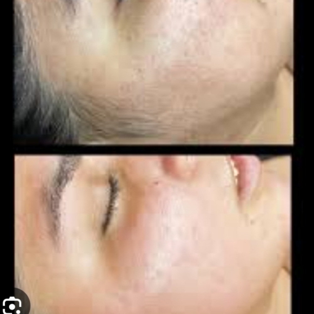 Full Face Waxing at FACEZ BY MONICA in Lakewood, CA