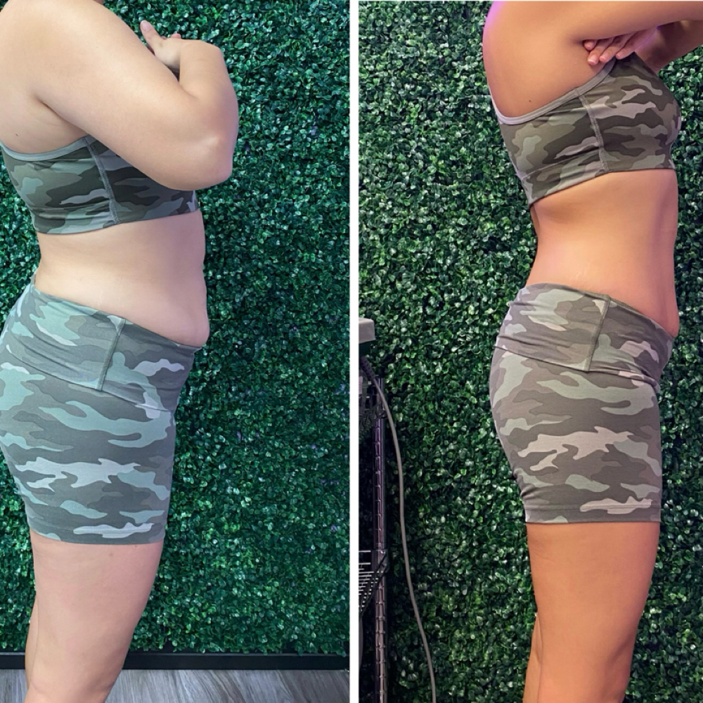 Divine Snatch and Sculpt Package at Divinity Essence Spa in Winter Springs, FL