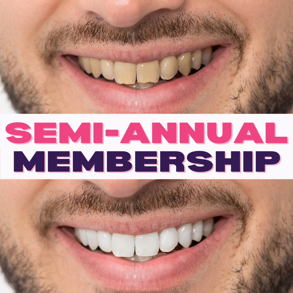 Semi-Annual Teeth Whitening Club at Beach Bum Teeth Whitening in Irmo, SC