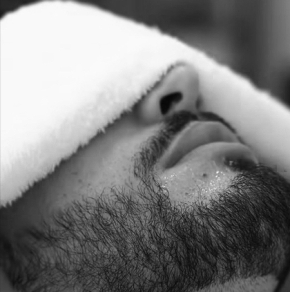 Beard + Ingrown Repair at His and Hers Co. in East Hartford, CT