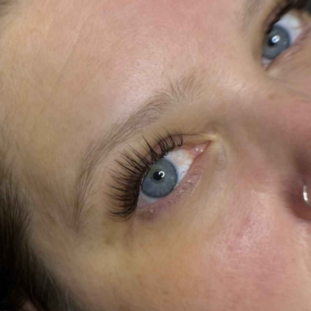 Classic Fill at Lexi Skin & Co in Round Rock, TX