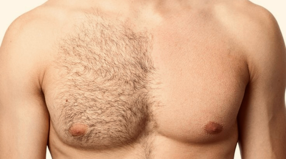 Chest Wax