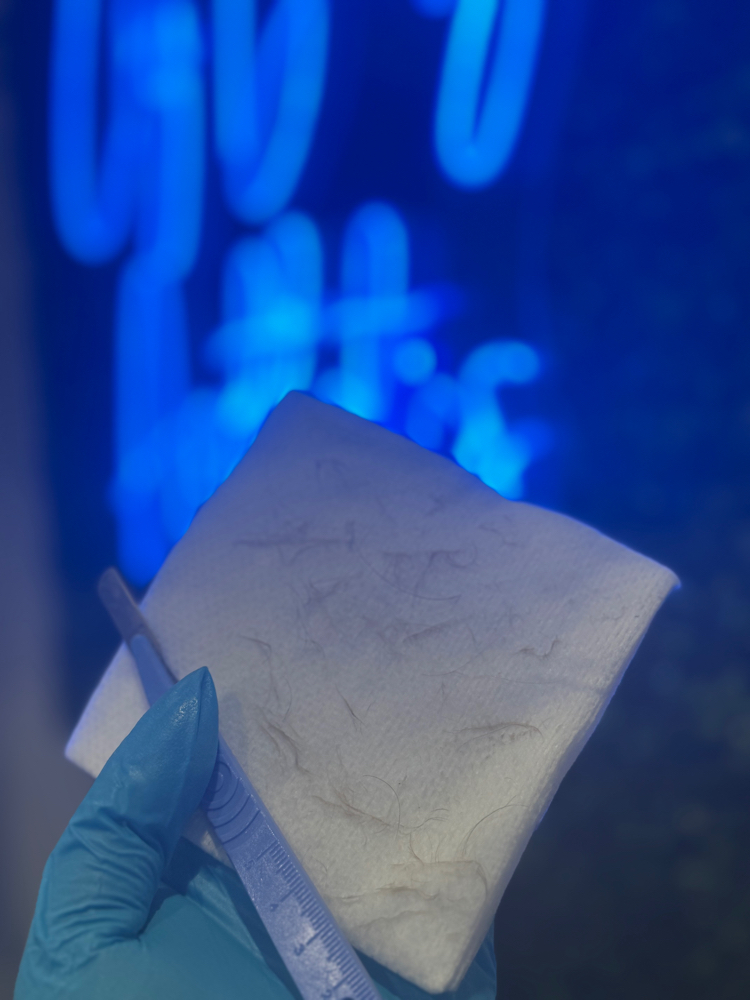 Dermaplaning Facials