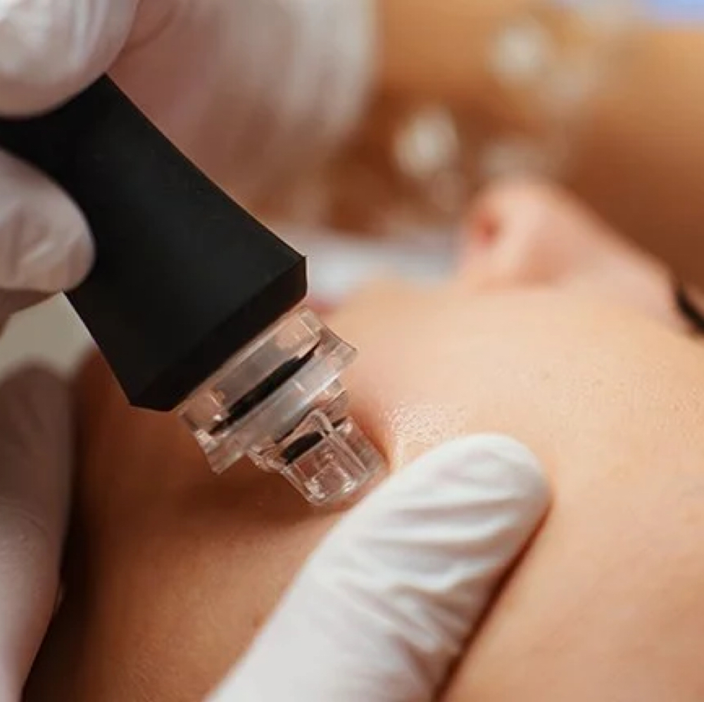 Hydrodermabrasion at Drop Dead Gorgeous Salon & Spa in Steele, ND