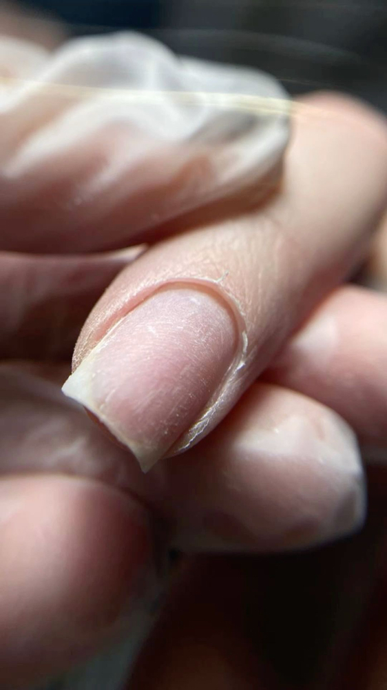 Nail Enhancement Removal