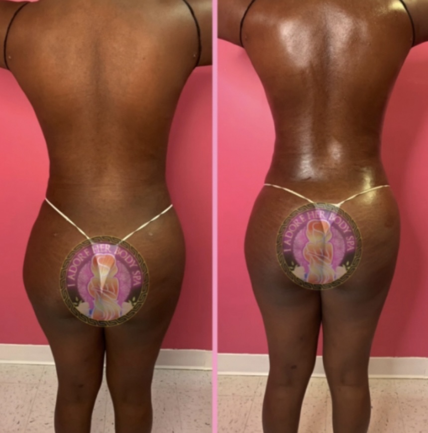 UltraSound Therapy & Lymph Drainage