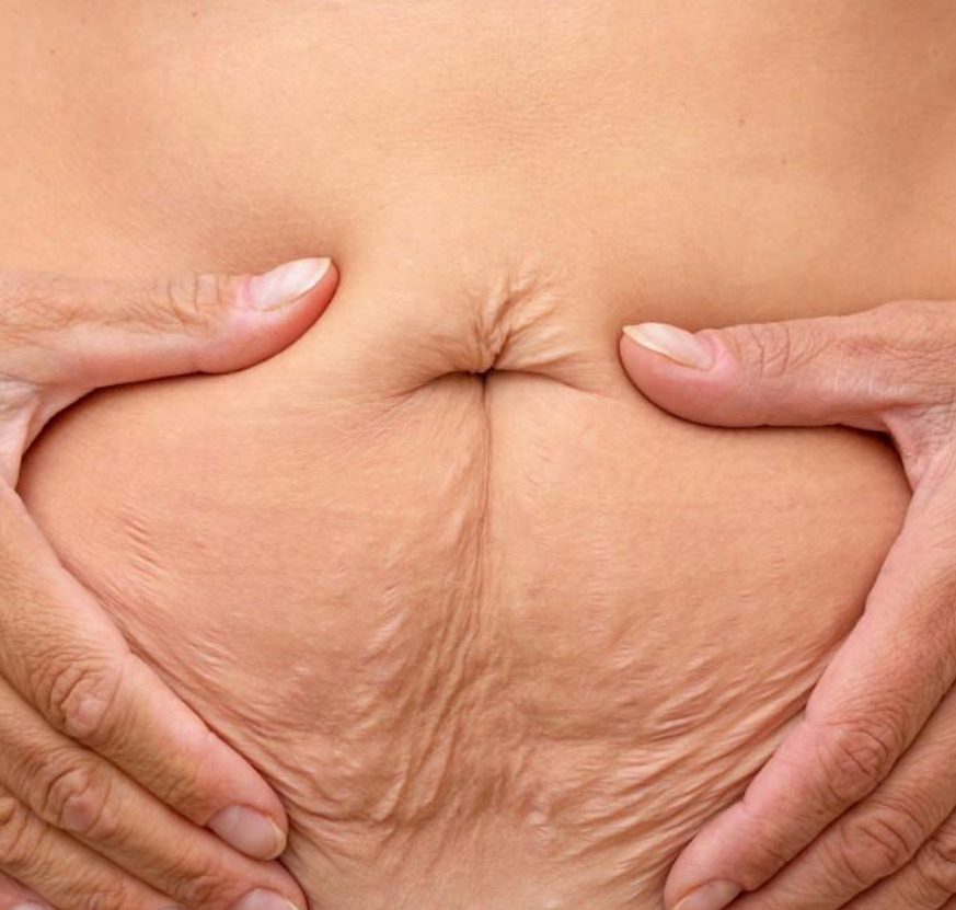 TLI | BODY FIRMING 10 Tx