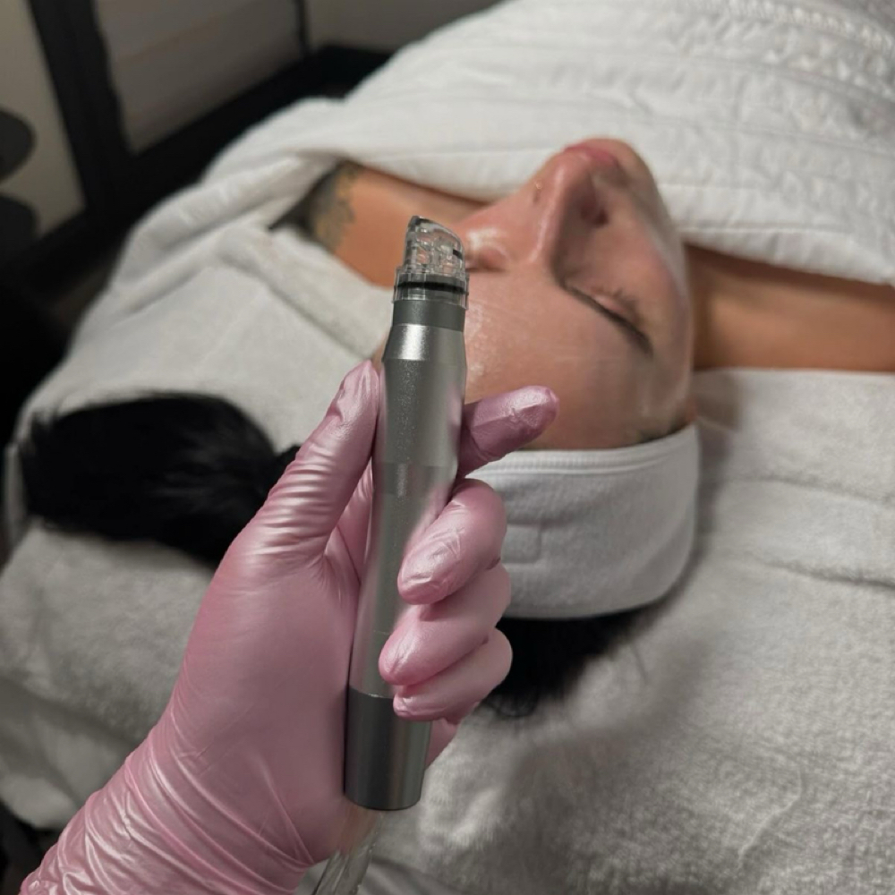 Hydrafacial + Dermaplane at Skin By Carly in LaFayette, GA