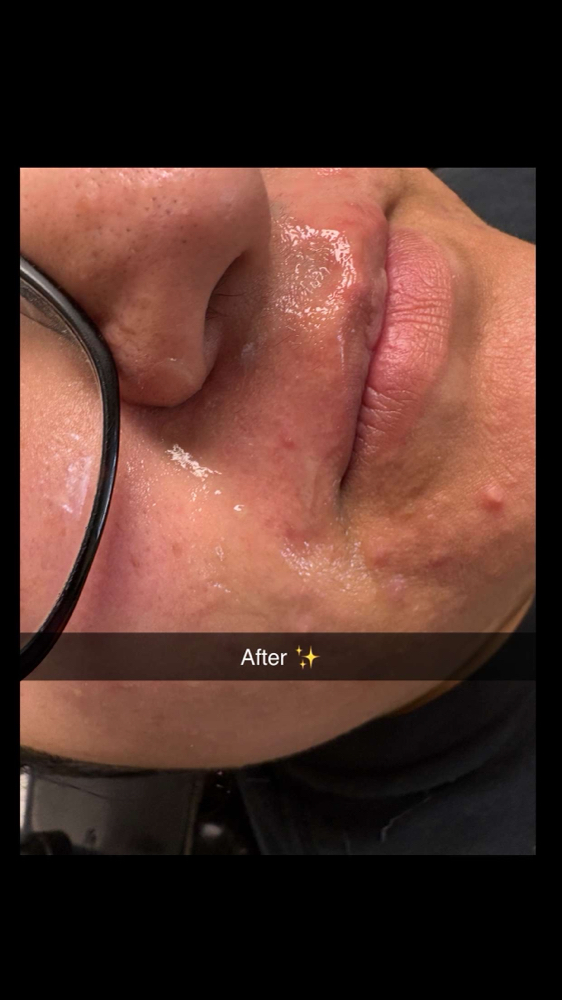 Lip Wax