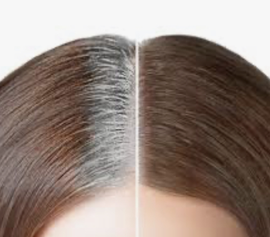 Root Touch Up