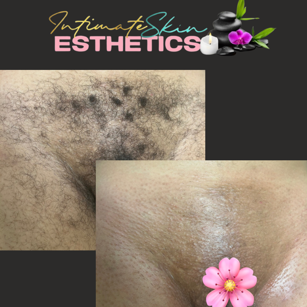 Intimate Waxing at Rockii’s intimate skin & esthetics in Va Beach, VA
