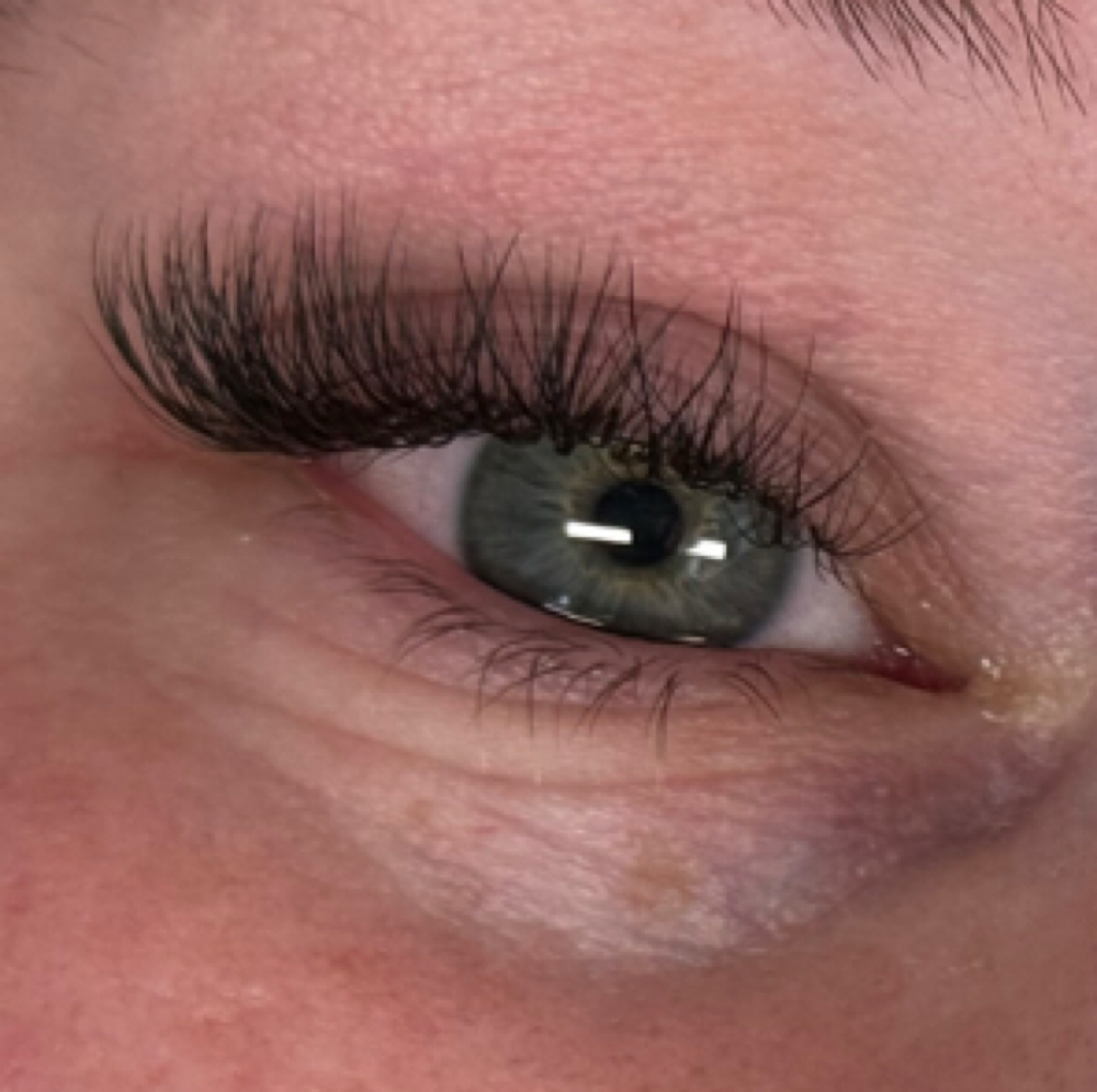 Hybrid  Full Set at Elizabeth  Beehler in Joplin, MO